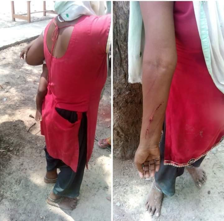 हिंदी समाचार |दबिश डालने गये दरोगा ने की...