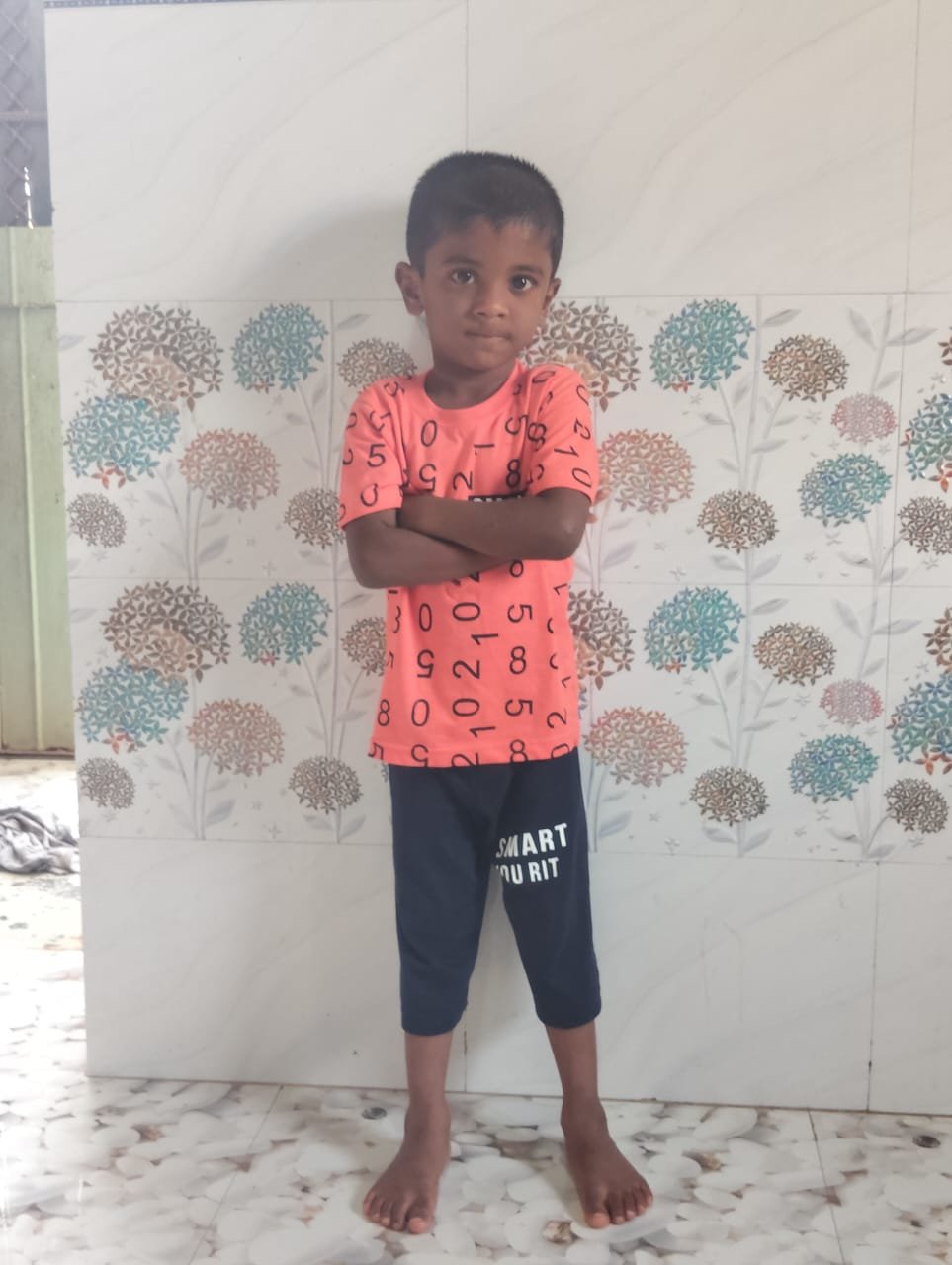 हिंदी समाचार |भिवंडी के पड़घा में डॉग बाइट...