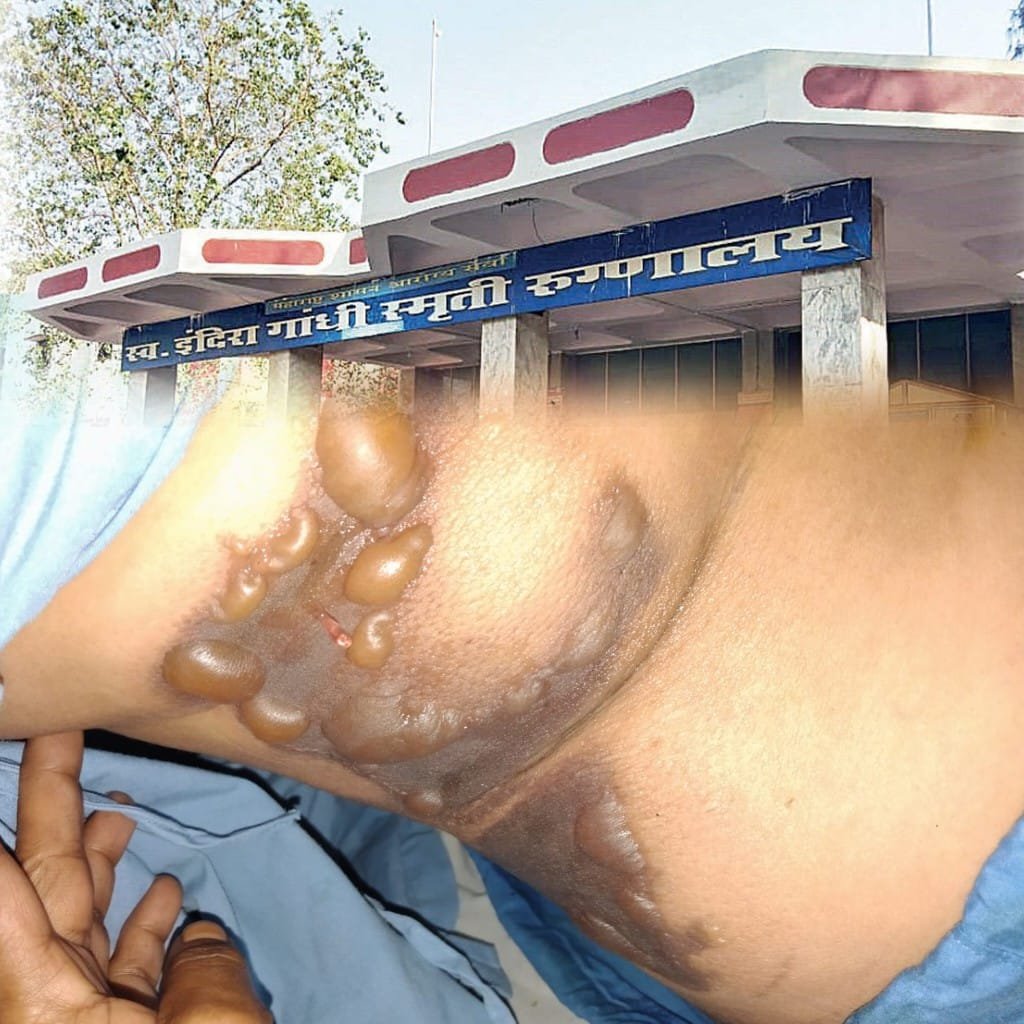 हिंदी समाचार |लेज़र ऑपरेशन के दौरान महिला...