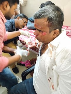 हिंदी समाचार |बीएसए जौनपुर की गाड़ी बनी आग का...