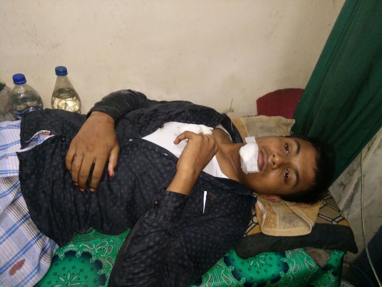 हिंदी समाचार |बदमाशो ने दो पर हमला कर लुटा