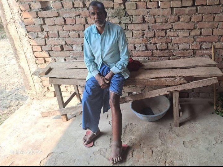 हिंदी समाचार |जानकारी के अभाव में नहीं करा...