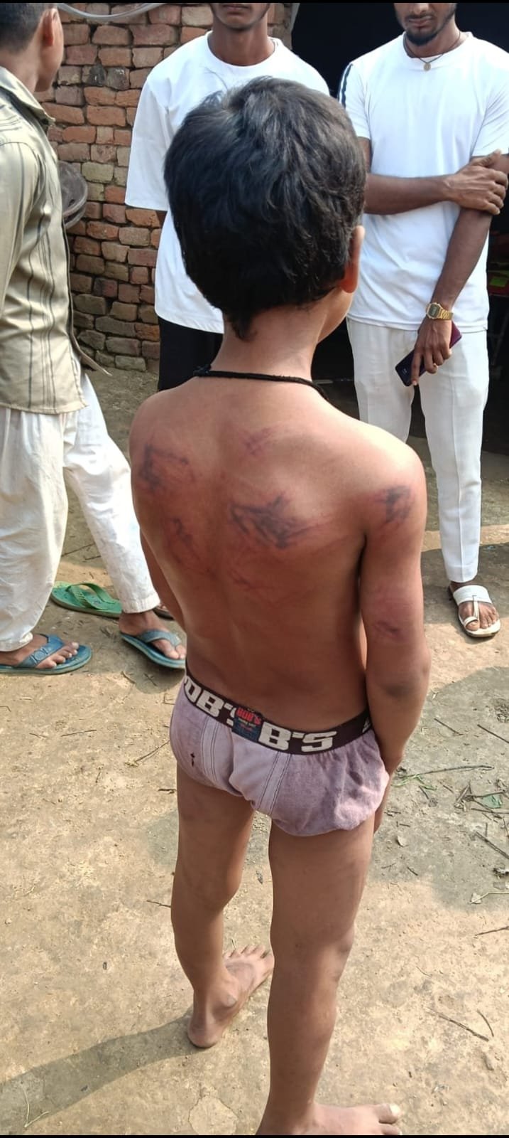 हिंदी समाचार |दुर्गावती में नाबालिग बच्चे...