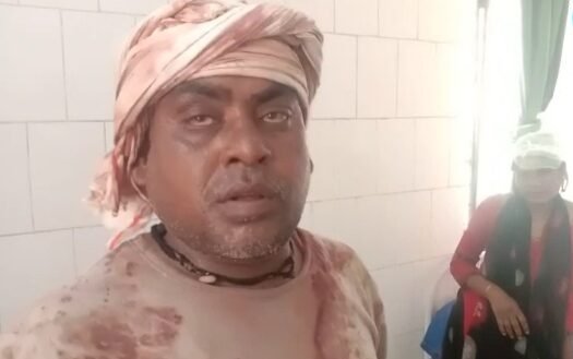 हिंदी समाचार |जौनपुर । दो पक्षों में मारपीट...