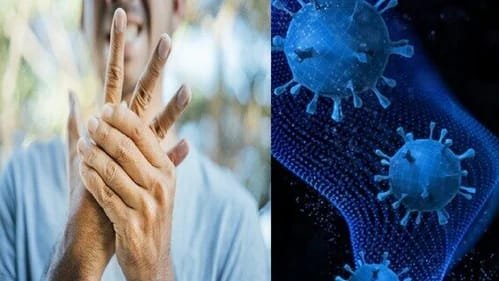 हिंदी समाचार |गुइलेन बैरी सिंड्रोम को लेकर...