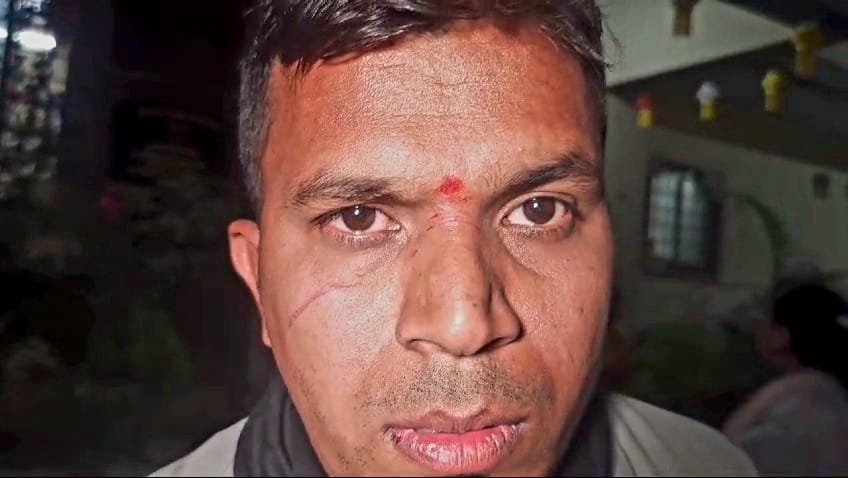 हिंदी समाचार |पतंग के मांझे से बाइक सवार...